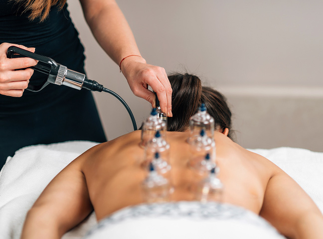 Cupping therapy